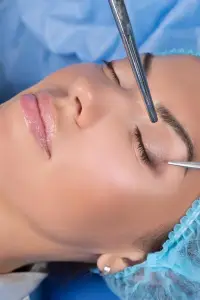 ¿Qué es la blefaroplastia?