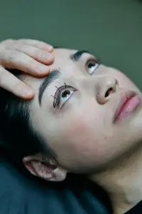 ¿Qué es la blefaroplastia?