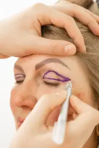 ¿Qué es la blefaroplastia?