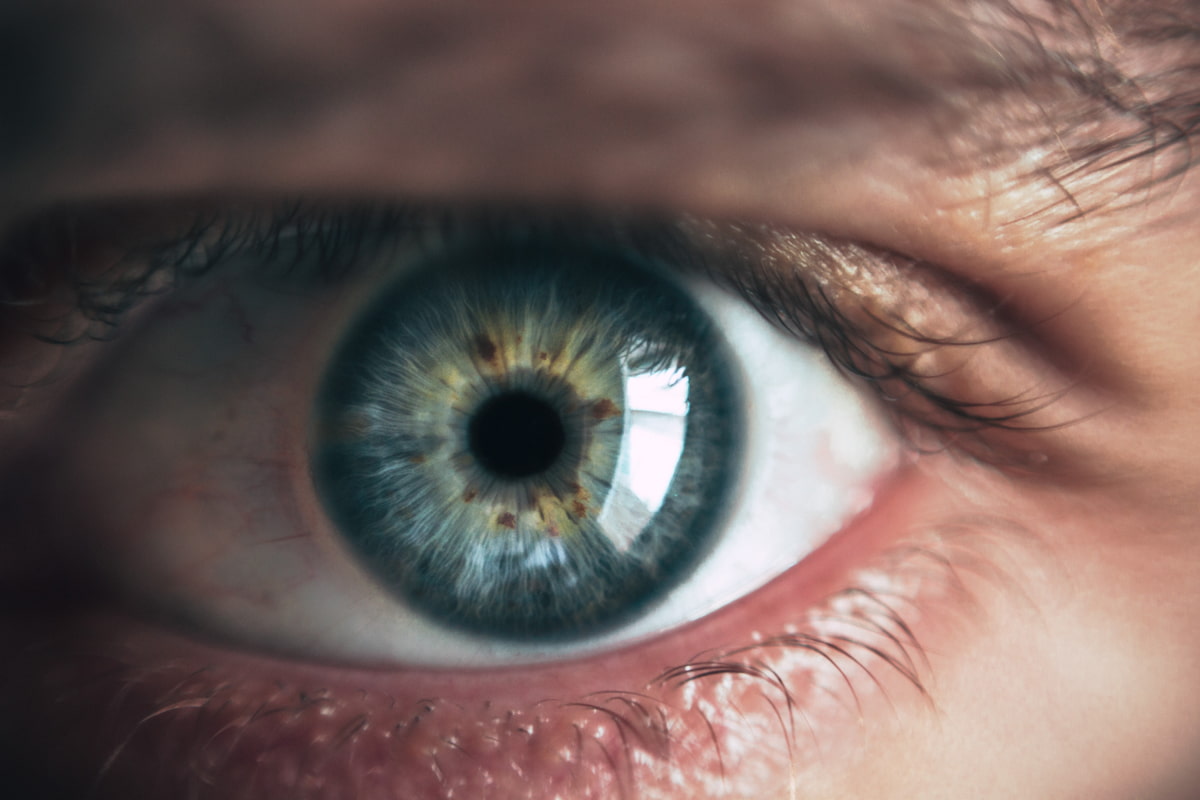 edema corneal