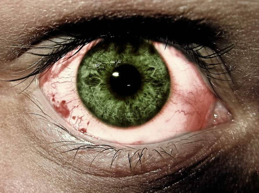 enrojecimiento de ojos