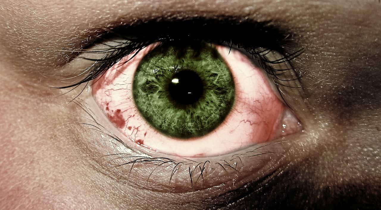 enrojecimiento de ojos